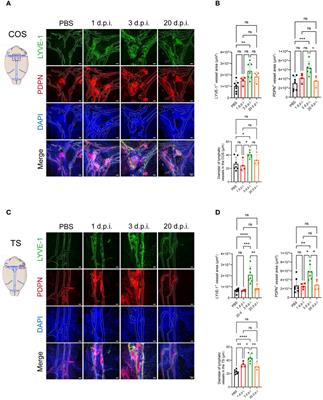 Impaired meningeal lymphatic drainage in Listeria monocytogenes infection